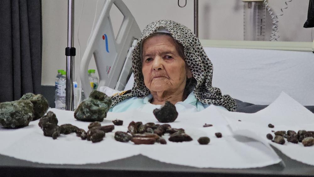 Yaşlı Kadının İçinden Çıkanlar 'Yok Artık' Dedirtti!