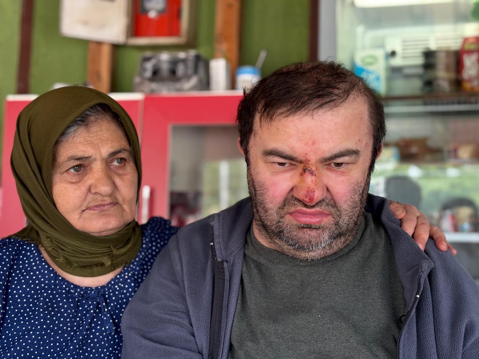 Bolu’da Şok Olay Yüzde 90 Engelli Adam Akrabası Tarafından Darp Edildi