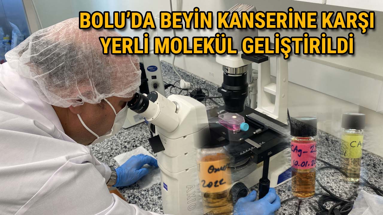 Bolu’dan Tüm Dünyaya Umut Beyin Kanserine Karşı Yerli Molekül Geliştirildi