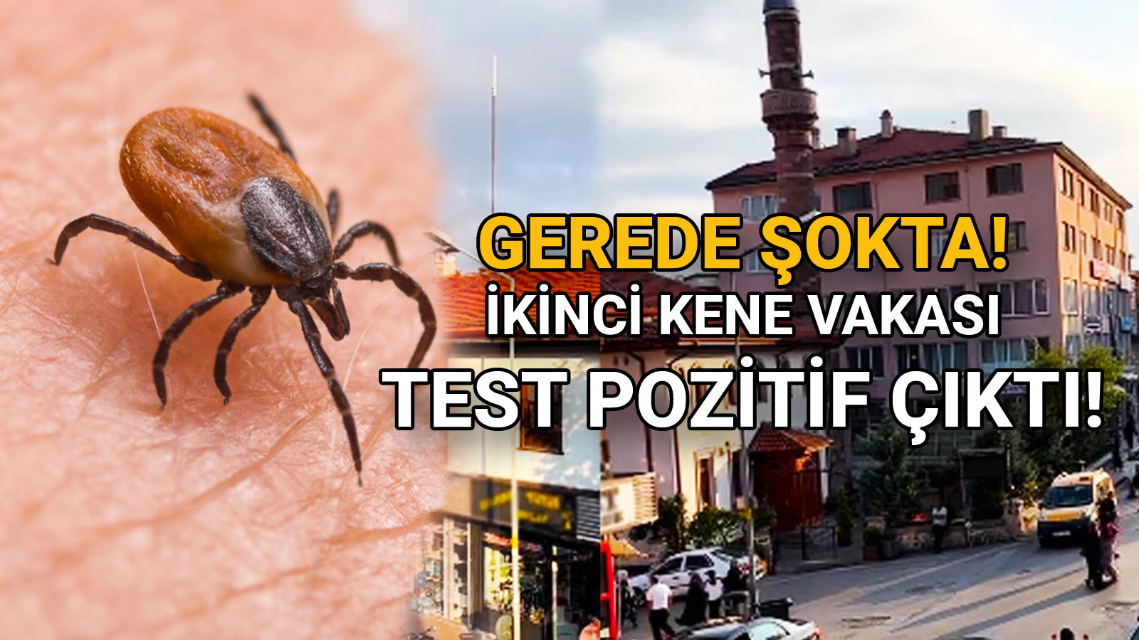 Gerede Şokta İkinci Kene Vakası, Test Pozitif Çıktı