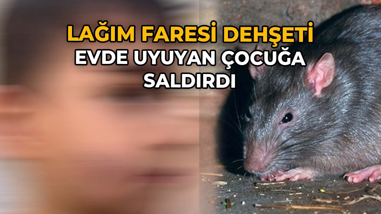 Lağım Faresi Evde Uyuyan Çocuğa Saldırdı