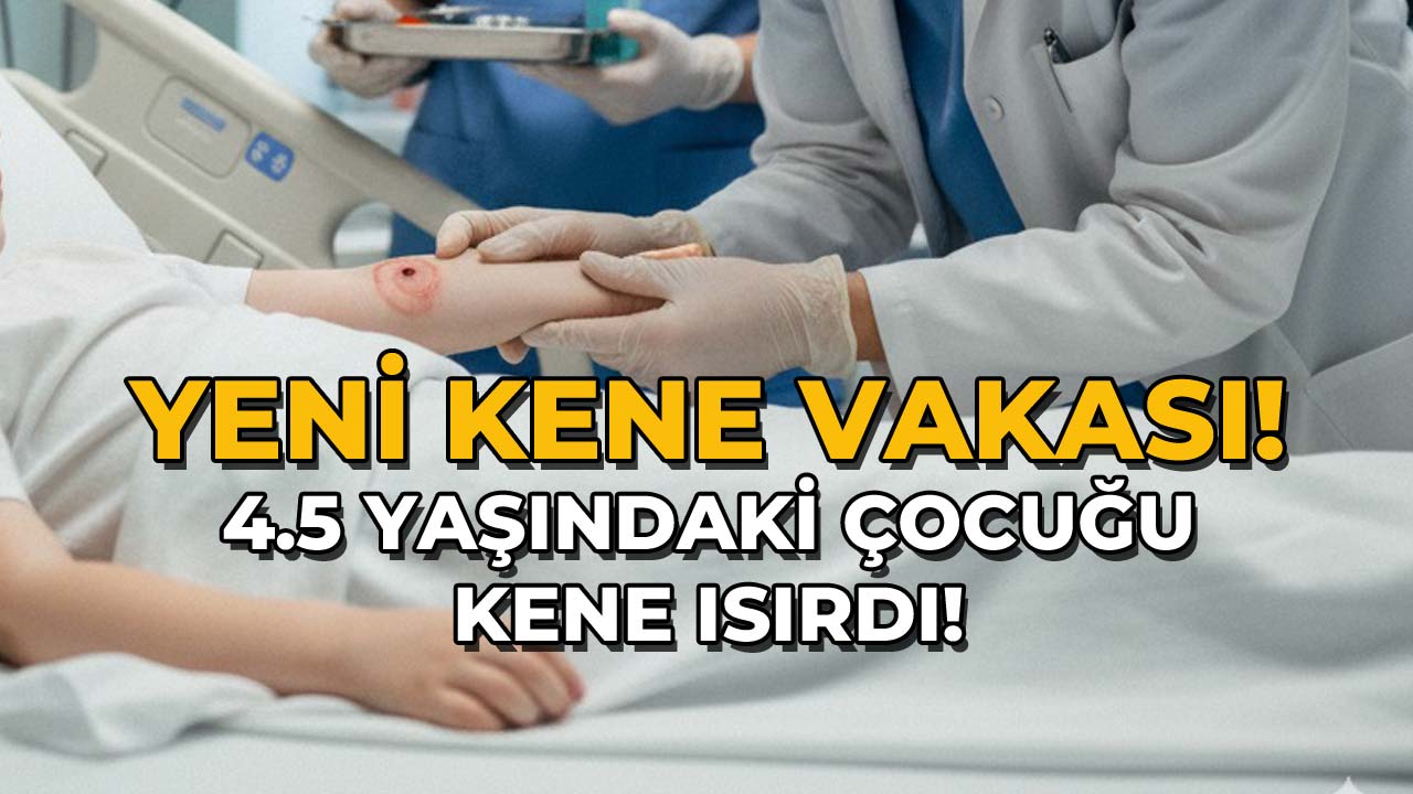 Yeni Kene Vakası 4 Yaşındaki Çocuğu Kene Isırdı